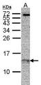 Replication Protein A3 antibody, GTX70238, GeneTex, Western Blot image 