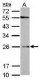 GST3 antibody, GTX112953, GeneTex, Western Blot image 