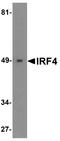 Interferon Regulatory Factor 4 antibody, A00401, Boster Biological Technology, Western Blot image 