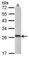 Deoxythymidylate Kinase antibody, GTX114371, GeneTex, Western Blot image 
