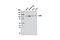 Janus Kinase 3 antibody, 8827S, Cell Signaling Technology, Western Blot image 