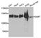 Phosphoribosylglycinamide Formyltransferase, Phosphoribosylglycinamide Synthetase, Phosphoribosylaminoimidazole Synthetase antibody, A3876, ABclonal Technology, Western Blot image 