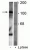 Gamma-Aminobutyric Acid Type B Receptor Subunit 1 antibody, P07297, Boster Biological Technology, Western Blot image 