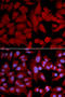 Proteasome Subunit Alpha 4 antibody, A06794, Boster Biological Technology, Western Blot image 