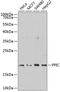 Peptidylprolyl Isomerase C antibody, GTX65991, GeneTex, Western Blot image 