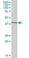 Proline-Serine-Threonine Phosphatase Interacting Protein 2 antibody, H00009050-B01P, Novus Biologicals, Western Blot image 