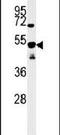 Secernin 1 antibody, PA5-25190, Invitrogen Antibodies, Western Blot image 