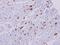 Major Histocompatibility Complex, Class II, DR Alpha antibody, GTX101865, GeneTex, Immunohistochemistry paraffin image 