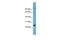 Semaphorin 3D antibody, GTX45262, GeneTex, Western Blot image 