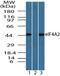 Eukaryotic Translation Initiation Factor 4A2 antibody, PA5-23264, Invitrogen Antibodies, Western Blot image 