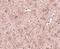 Ceramide Synthase 6 antibody, NBP1-76965, Novus Biologicals, Immunohistochemistry frozen image 