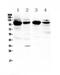 Vascular Cell Adhesion Molecule 1 antibody, PA5-80213, Invitrogen Antibodies, Western Blot image 
