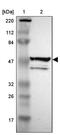 UDP-GlcNAc:BetaGal Beta-1,3-N-Acetylglucosaminyltransferase 2 antibody, PA5-52237, Invitrogen Antibodies, Western Blot image 