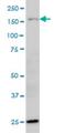 Hypoxia Up-Regulated 1 antibody, H00010525-M01, Novus Biologicals, Western Blot image 