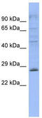 Pleckstrin Homology Domain Containing B2 antibody, TA335914, Origene, Western Blot image 