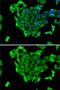 Ribosomal Protein S14 antibody, GTX32849, GeneTex, Immunocytochemistry image 