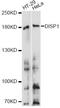 Dispatched RND Transporter Family Member 1 antibody, A14946, ABclonal Technology, Western Blot image 