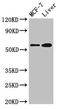 Cystathionine-Beta-Synthase antibody, CSB-PA12719A0Rb, Cusabio, Western Blot image 