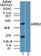 Arrestin Beta 2 antibody, PA5-23296, Invitrogen Antibodies, Western Blot image 