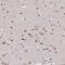 Regulatory Factor X1 antibody, NBP2-13223, Novus Biologicals, Immunohistochemistry frozen image 