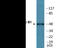 Cycb antibody, EKC1984, Boster Biological Technology, Western Blot image 