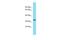 Transmembrane Protein 241 antibody, A16720, Boster Biological Technology, Western Blot image 