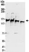 Solute Carrier Family 16 Member 2 antibody, NBP2-32109, Novus Biologicals, Western Blot image 