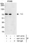 Tether containing UBX domain for GLUT4 antibody, NBP1-28710, Novus Biologicals, Immunoprecipitation image 