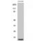 Eukaryotic Translation Initiation Factor 4E Binding Protein 1 antibody, LS-C381824, Lifespan Biosciences, Western Blot image 