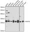 NADH:Ubiquinone Oxidoreductase Core Subunit S3 antibody, GTX64675, GeneTex, Western Blot image 