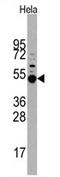 MAPK Activated Protein Kinase 5 antibody, AP13894PU-N, Origene, Western Blot image 