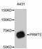 Protein Arginine Methyltransferase 5 antibody, abx125383, Abbexa, Western Blot image 
