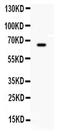 Butyrylcholinesterase antibody, PA5-78861, Invitrogen Antibodies, Western Blot image 