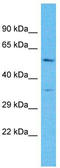 Olfactory Receptor Family 4 Subfamily C Member 16 (Gene/Pseudogene) antibody, TA337503, Origene, Western Blot image 