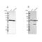 Glucose-6-Phosphate Dehydrogenase antibody, NBP1-89804, Novus Biologicals, Western Blot image 