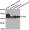 Tropomyosin 3 antibody, A13557, ABclonal Technology, Western Blot image 