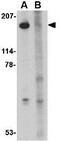 SLIT And NTRK Like Family Member 5 antibody, GTX85413, GeneTex, Western Blot image 