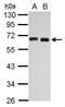 Hyaluronan Synthase 3 antibody, NBP2-16782, Novus Biologicals, Western Blot image 