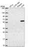 TERF1 Interacting Nuclear Factor 2 antibody, NBP2-55709, Novus Biologicals, Western Blot image 