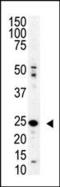 Sentrin-specific protease 8 antibody, PA5-11357, Invitrogen Antibodies, Western Blot image 