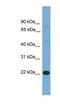 Interleukin 17D antibody, NBP1-79686, Novus Biologicals, Western Blot image 