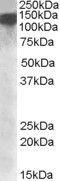 DExH-Box Helicase 9 antibody, GTX88436, GeneTex, Western Blot image 