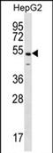 NF-kappa-B-activating protein antibody, PA5-71694, Invitrogen Antibodies, Western Blot image 