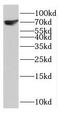 Potassium Calcium-Activated Channel Subfamily N Member 1 antibody, FNab04496, FineTest, Western Blot image 