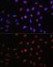 Transcription Factor 4 antibody, GTX16385, GeneTex, Immunofluorescence image 