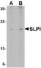 Secretory Leukocyte Peptidase Inhibitor antibody, A01682, Boster Biological Technology, Western Blot image 