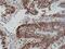 MutS Homolog 6 antibody, NBP2-77434, Novus Biologicals, Immunohistochemistry frozen image 