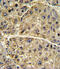 Collagen Type VI Alpha 1 Chain antibody, 62-345, ProSci, Immunohistochemistry paraffin image 