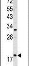 ADP Ribosylation Factor 3 antibody, PA5-13547, Invitrogen Antibodies, Western Blot image 