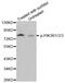 Phosphoinositide-3-Kinase Regulatory Subunit 1 antibody, MBS128300, MyBioSource, Western Blot image 